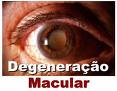 Degeneração Macular - Prevenção ainda é o melhor remédio